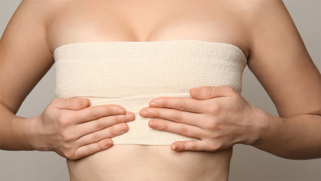bruststraffung-nach-liposuktion
